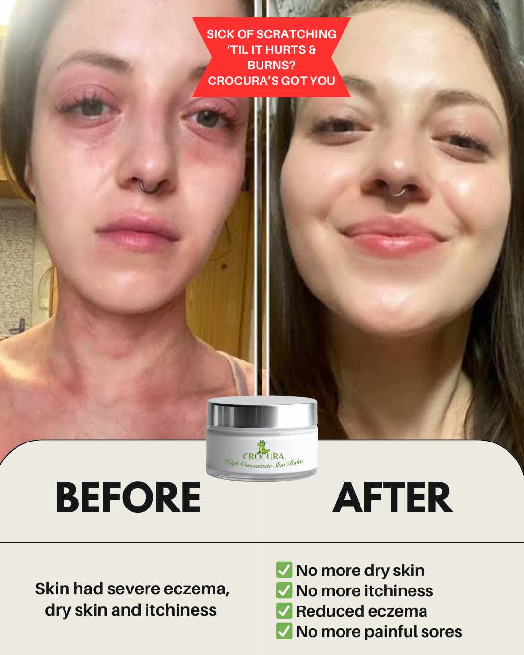 Crocura Soothing Skin Balm