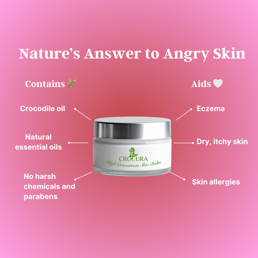 Crocura Soothing Skin Balm (Buy One, Get One FREE)