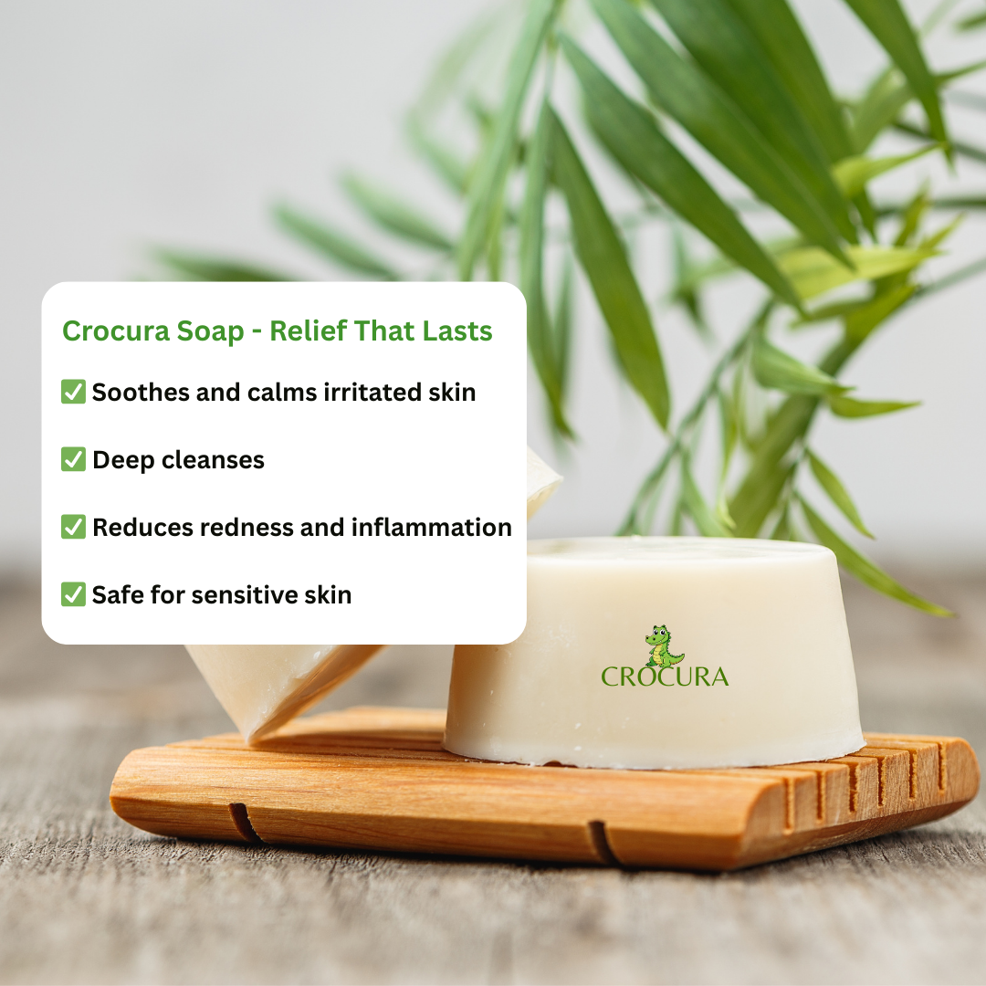 Crocura Soothing Skin Balm (Buy One, Get One FREE)