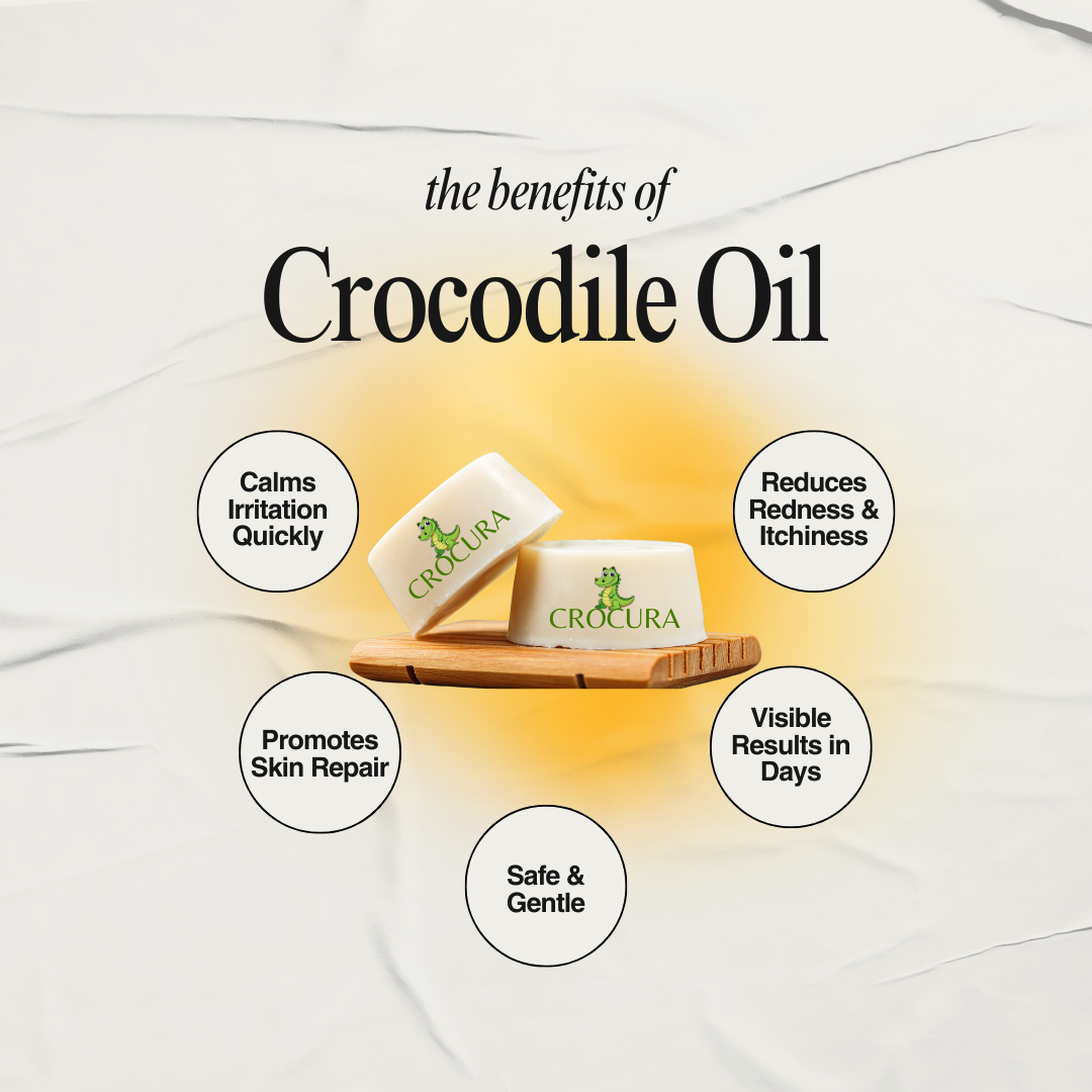 Crocura Soothing Soap