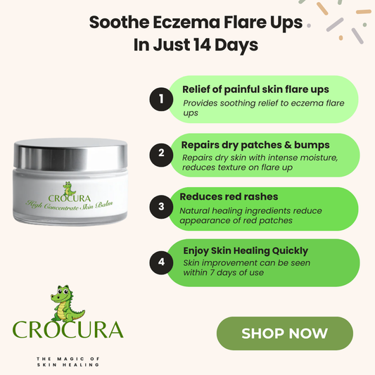 Crocura Soothing Skin Balm
