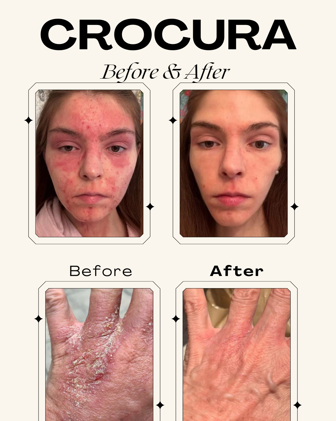 Crocura Soothing Skin Balm